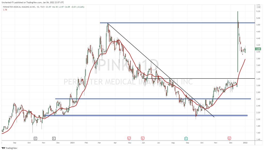 Perimeter Medical